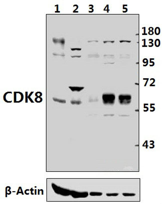 CDK8 Antibody in Western Blot (WB)