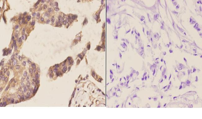 NCBP2 Antibody in Immunohistochemistry (Paraffin) (IHC (P))