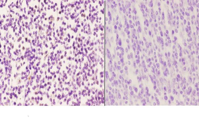 LMO4 Antibody in Immunohistochemistry (Paraffin) (IHC (P))