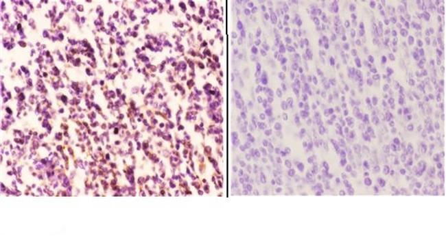 MEF2B Antibody in Immunohistochemistry (Paraffin) (IHC (P))