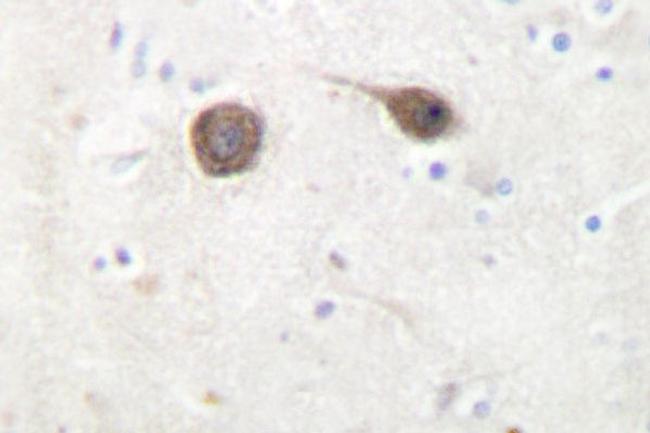 JIP2 Antibody in Immunohistochemistry (Paraffin) (IHC (P))