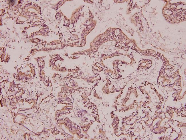 BRMS1 Antibody in Immunohistochemistry (Paraffin) (IHC (P))