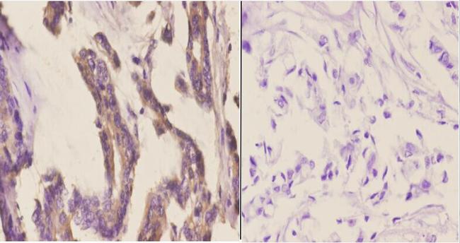 CYP2A13 Antibody in Immunohistochemistry (Paraffin) (IHC (P))