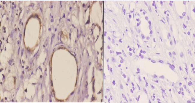 TANK Antibody in Immunohistochemistry (Paraffin) (IHC (P))