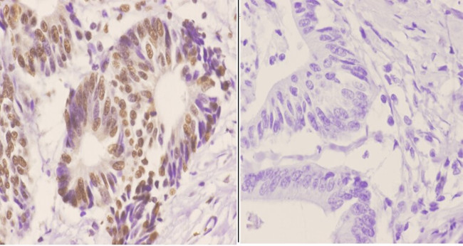 hnRNP C1/C2 Antibody in Immunohistochemistry (Paraffin) (IHC (P))