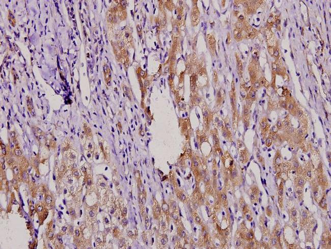 MKP4 Antibody in Immunohistochemistry (Paraffin) (IHC (P))