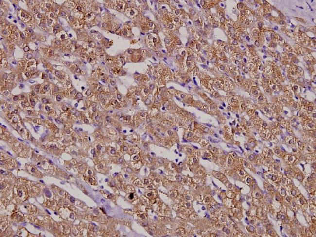 MSH3 Antibody in Immunohistochemistry (Paraffin) (IHC (P))