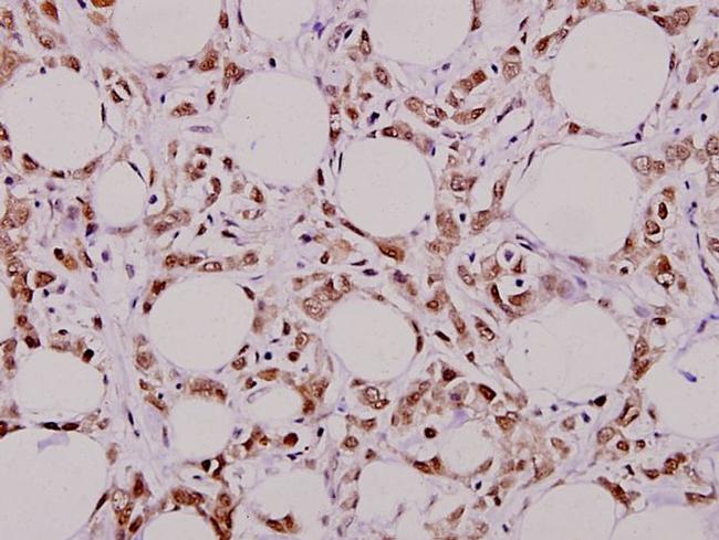 MUTYH Antibody in Immunohistochemistry (Paraffin) (IHC (P))