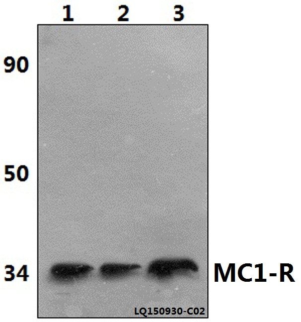 MC1R Antibody in Western Blot (WB)