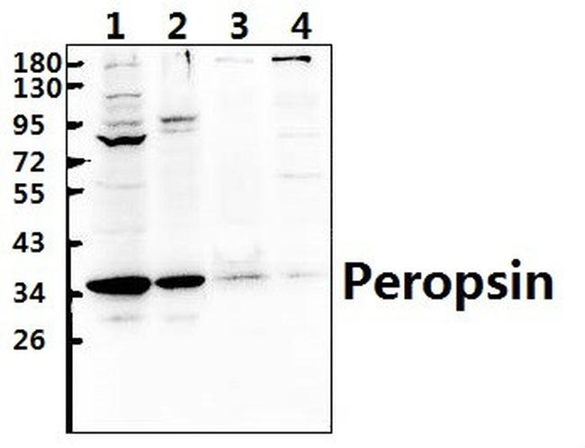 RRH Antibody in Western Blot (WB)