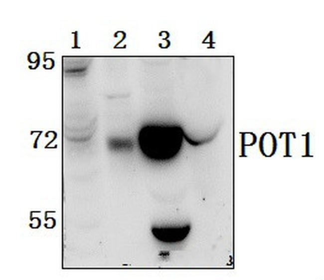 POT1 Antibody in Western Blot (WB)