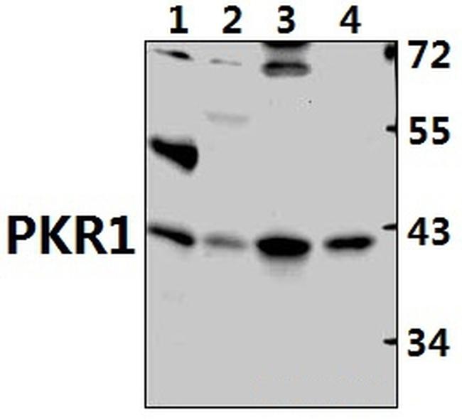 Prokineticin Receptor 1 Antibody in Western Blot (WB)