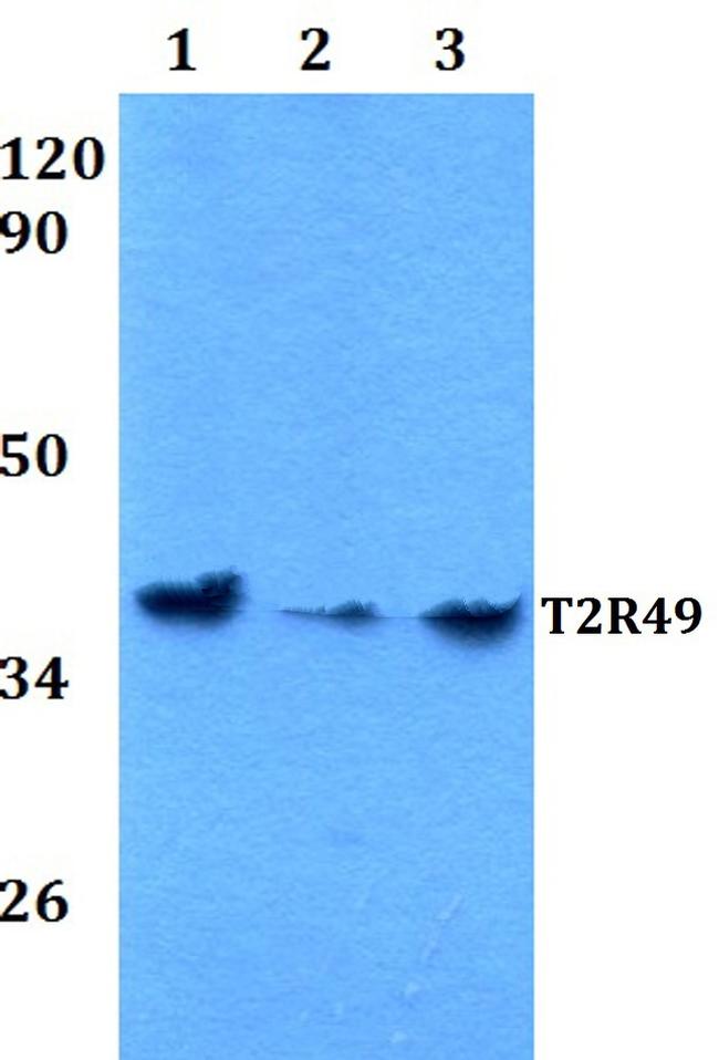 TAS2R20 Antibody in Western Blot (WB)