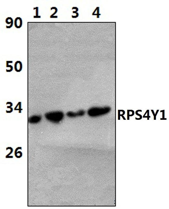 RPS4Y1 Antibody in Western Blot (WB)