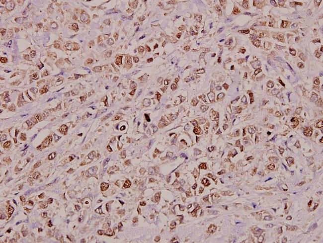 KDELR2 Antibody in Immunohistochemistry (Paraffin) (IHC (P))