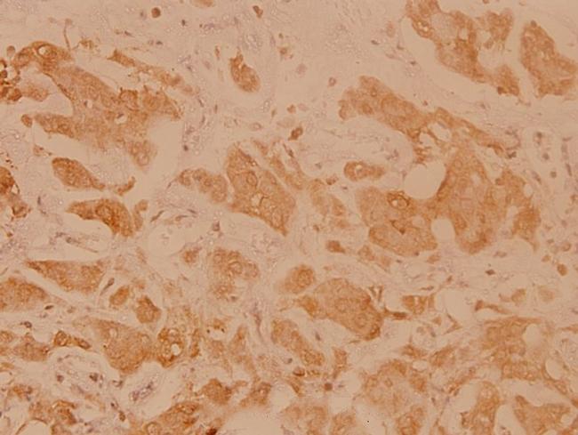 HLA-DOA Antibody in Immunohistochemistry (Paraffin) (IHC (P))