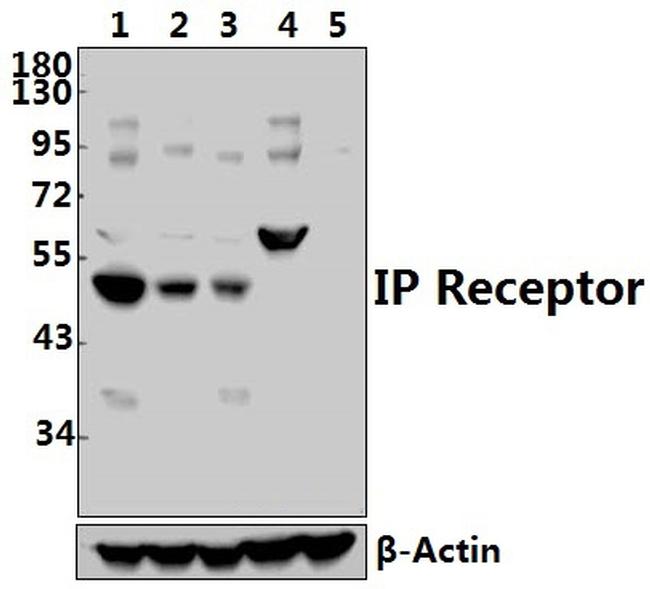 PTGIR Antibody in Western Blot (WB)