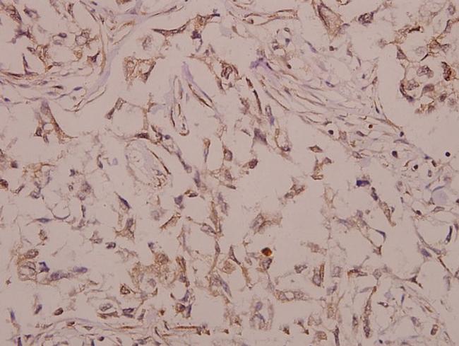 BMP-5 Antibody in Immunohistochemistry (Paraffin) (IHC (P))