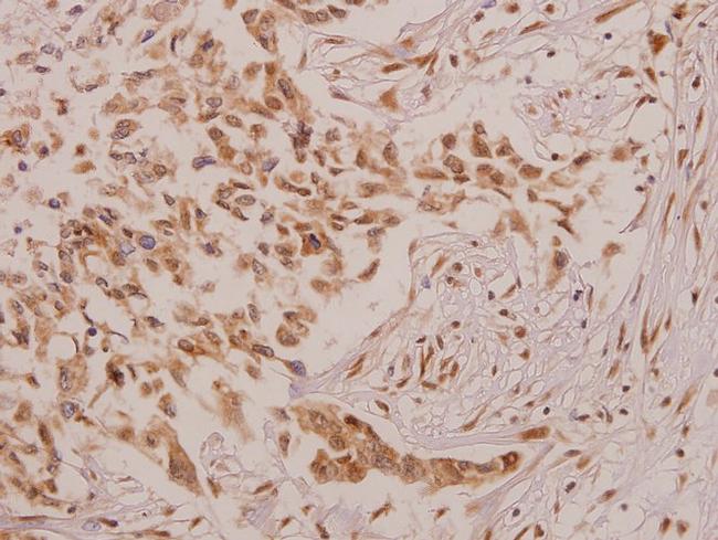 DEFA4 Antibody in Immunohistochemistry (Paraffin) (IHC (P))