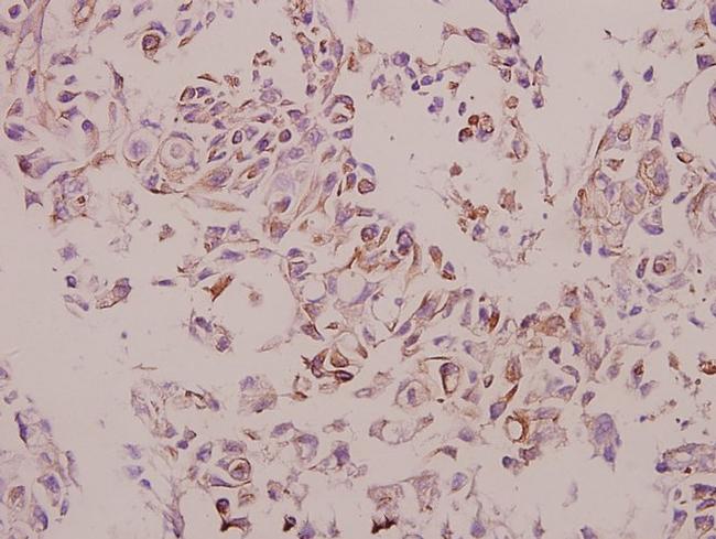 Cathepsin H Antibody in Immunohistochemistry (Paraffin) (IHC (P))