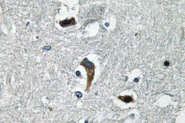 KCNMB4 Antibody in Immunohistochemistry (Paraffin) (IHC (P))