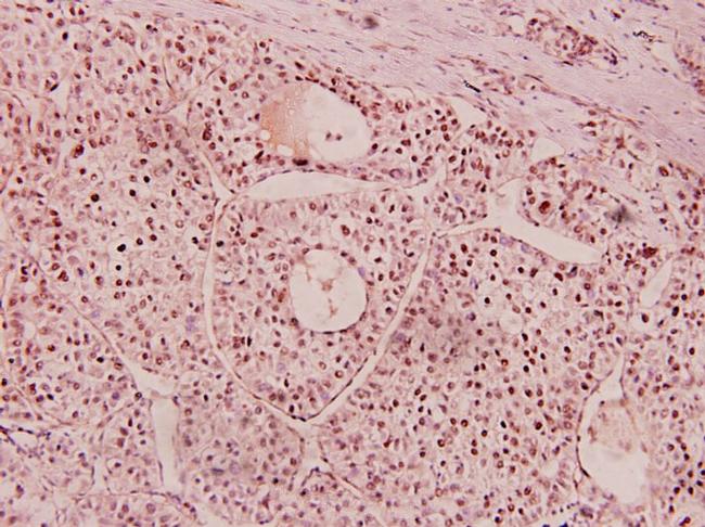 NTN1 Antibody in Immunohistochemistry (Paraffin) (IHC (P))