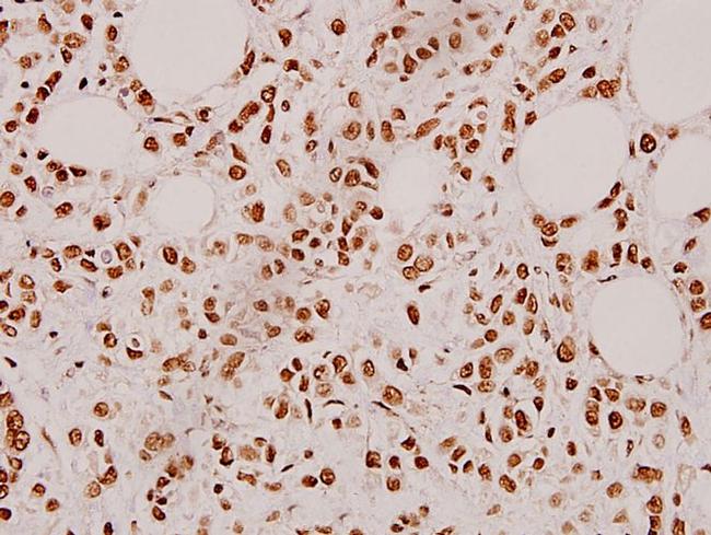 Cardiotrophin 1 Antibody in Immunohistochemistry (Paraffin) (IHC (P))