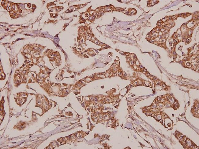 SLC25A6 Antibody in Immunohistochemistry (Paraffin) (IHC (P))