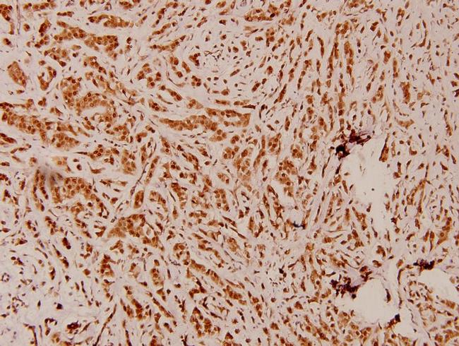 PEX14 Antibody in Immunohistochemistry (Paraffin) (IHC (P))