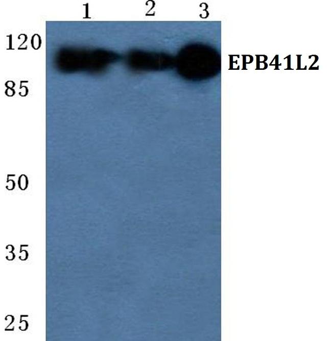 EPB41L2 Antibody in Western Blot (WB)