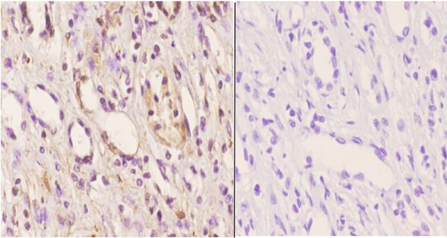 ABCD4 Antibody in Immunohistochemistry (Paraffin) (IHC (P))