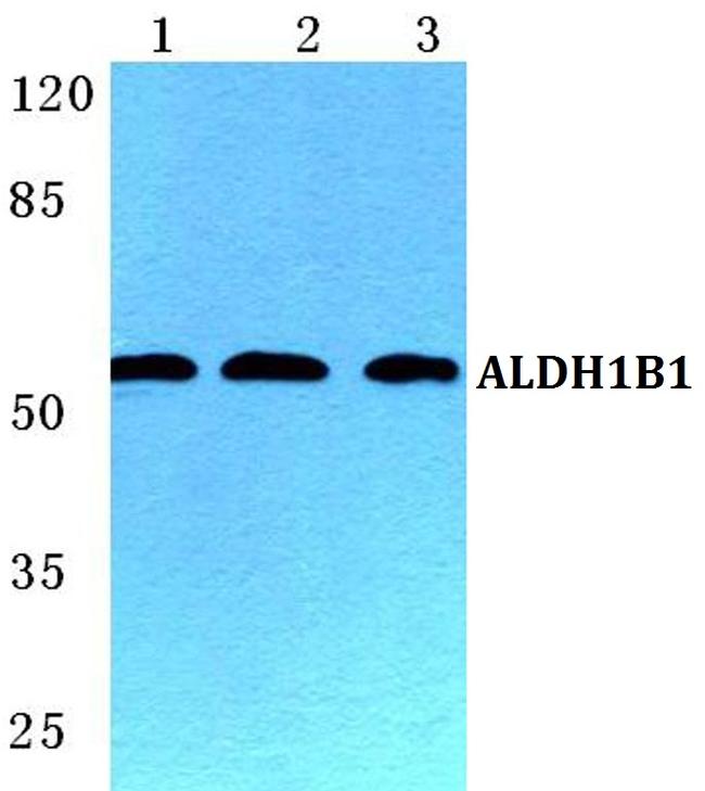 ALDH1B1 Antibody in Western Blot (WB)