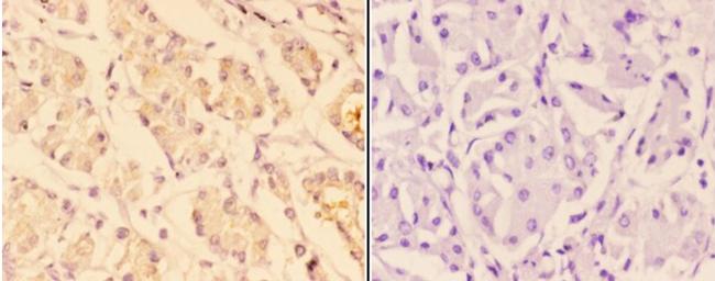 Arp3 Antibody in Immunohistochemistry (Paraffin) (IHC (P))