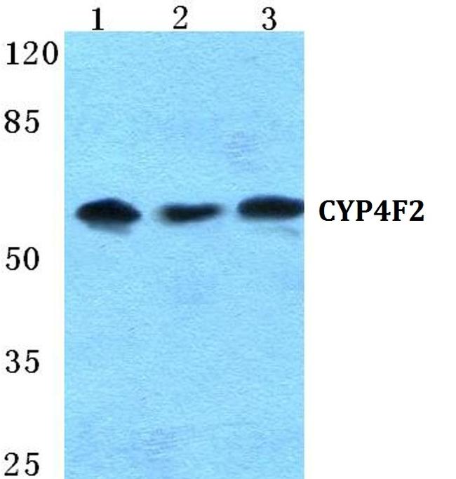 CYP4F2 Antibody in Western Blot (WB)