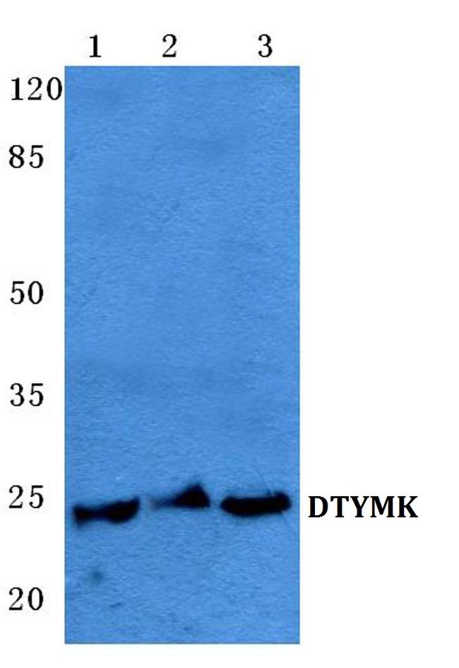 DTYMK Antibody in Western Blot (WB)