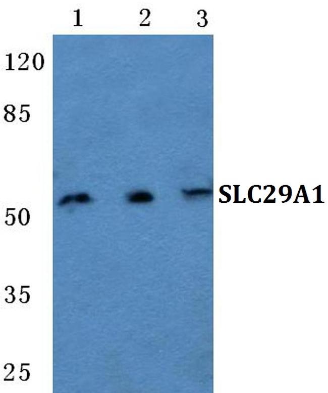 ENT1 Antibody in Western Blot (WB)