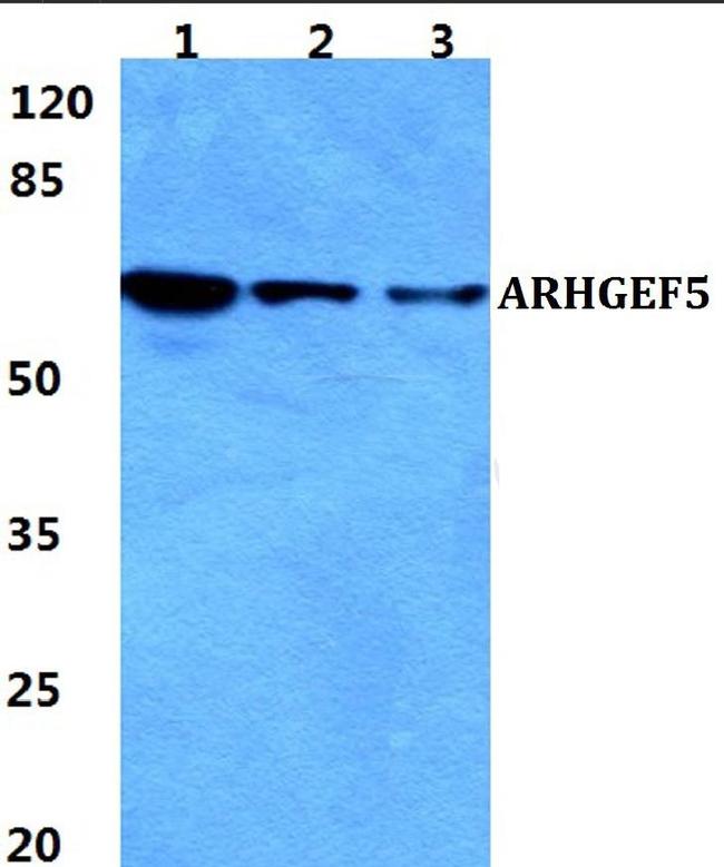 GEF5 Antibody in Western Blot (WB)