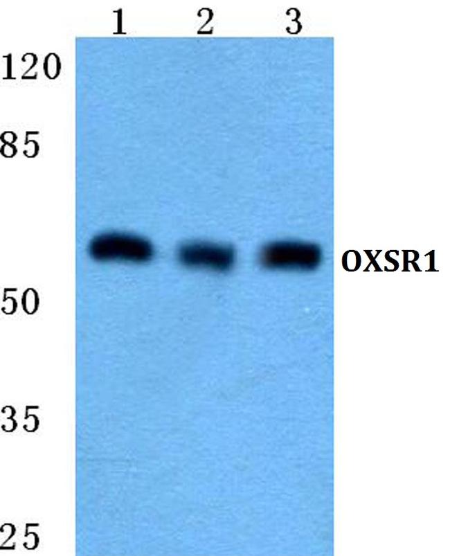 OXSR1 Antibody in Western Blot (WB)