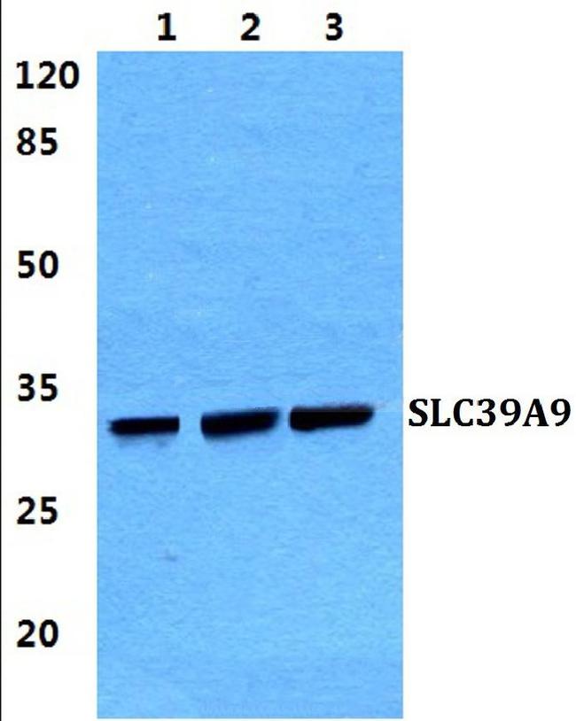 SLC39A9 Antibody in Western Blot (WB)