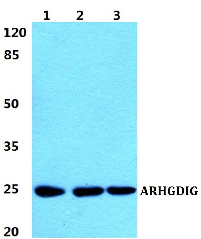 ARHGDIG Antibody in Western Blot (WB)