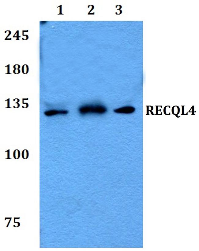 RECQ4 Antibody in Western Blot (WB)