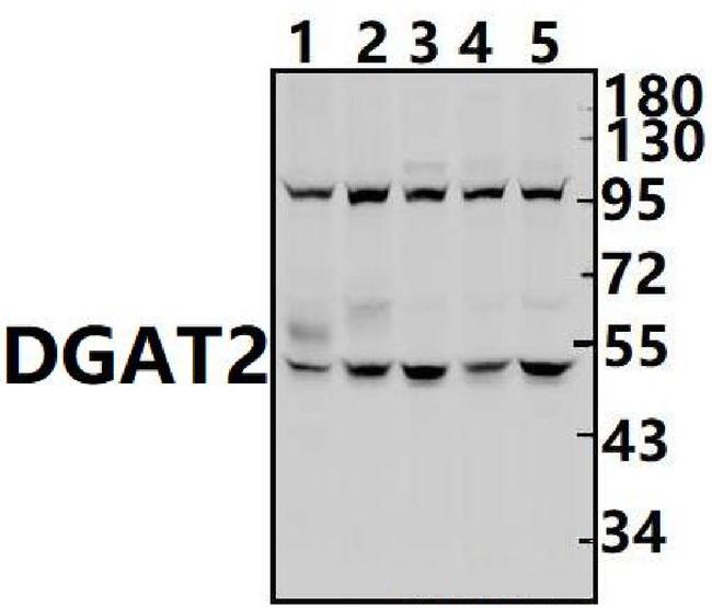 DGAT2 Antibody in Western Blot (WB)