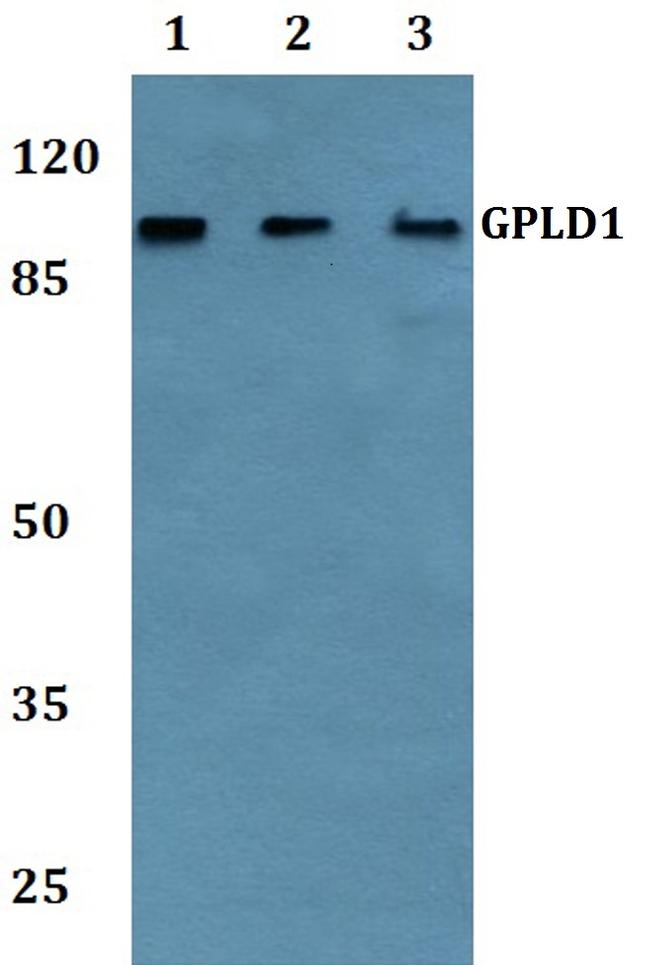 GPLD1 Antibody in Western Blot (WB)