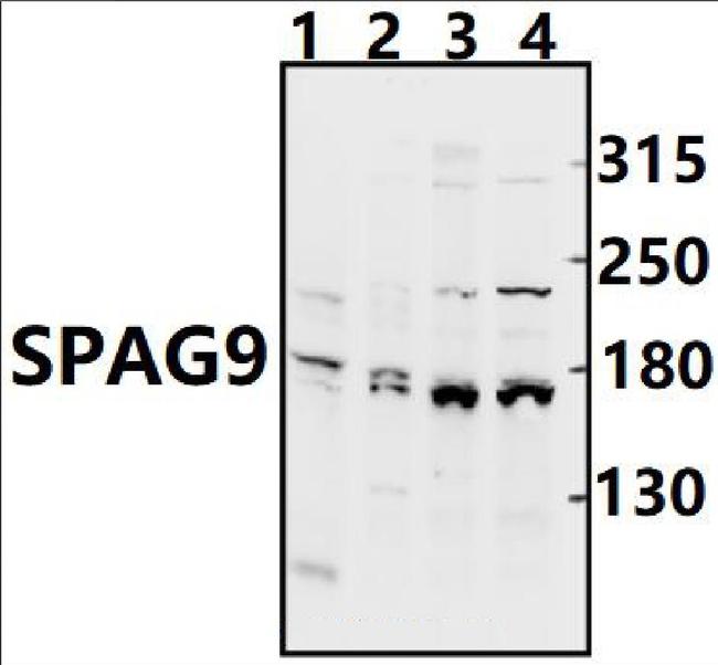 JLP Antibody in Western Blot (WB)