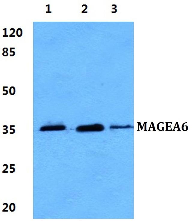 MAGEA6 Antibody in Western Blot (WB)