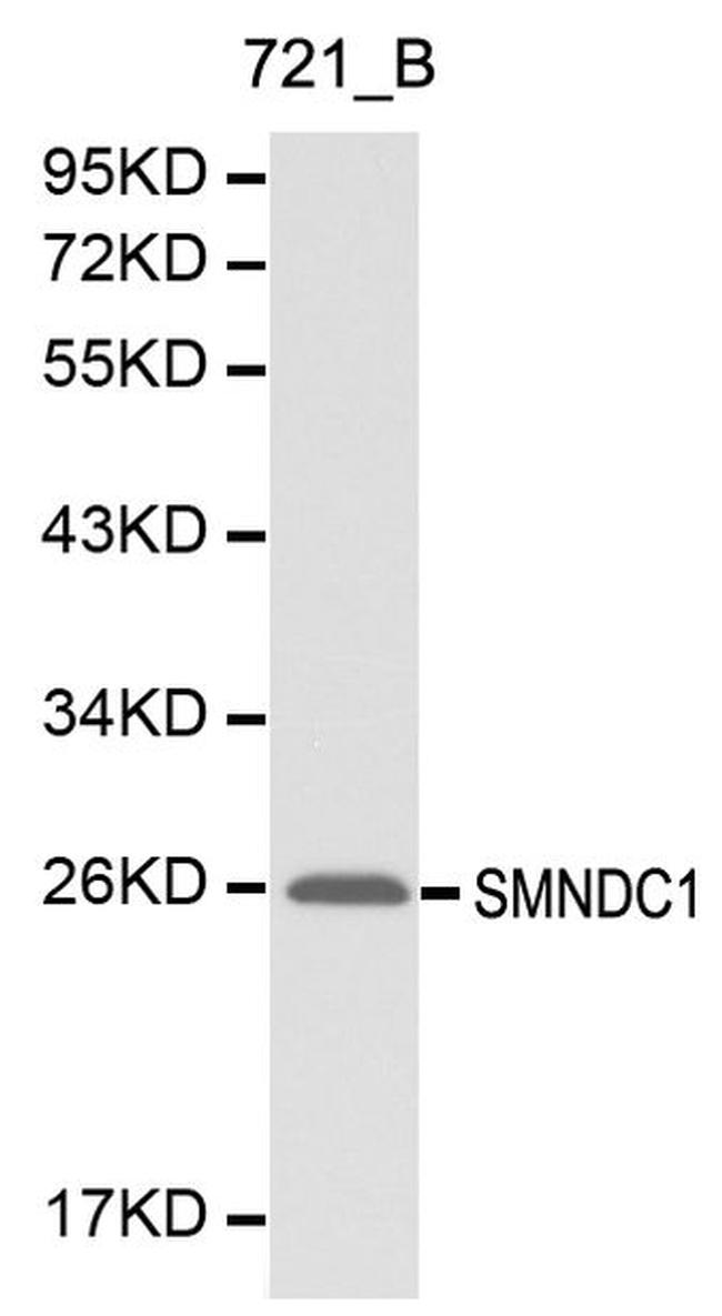 SMNDC1 Antibody in Western Blot (WB)