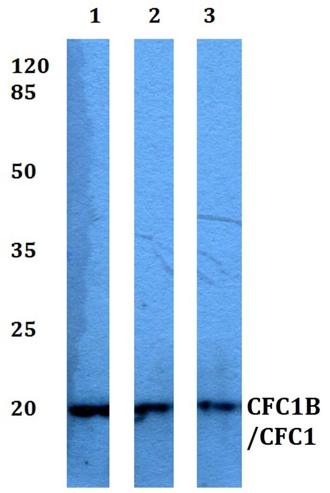 CFC1B/CFC1 Antibody in Western Blot (WB)