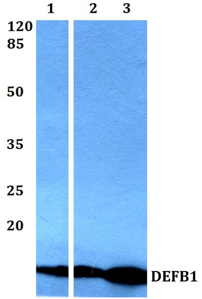 beta-Defensin 1 Antibody in Western Blot (WB)