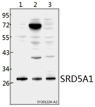 SRD5A1 Antibody in Western Blot (WB)