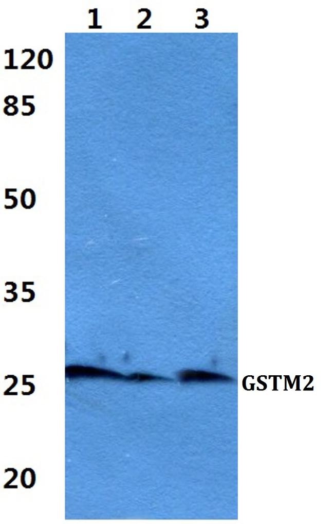 GSTM2 Antibody in Western Blot (WB)